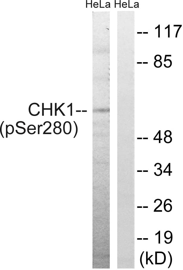 Polyclonal Rabbit anti-Human CHEK1 / CHK1 Antibody (phospho-Ser280, WB)