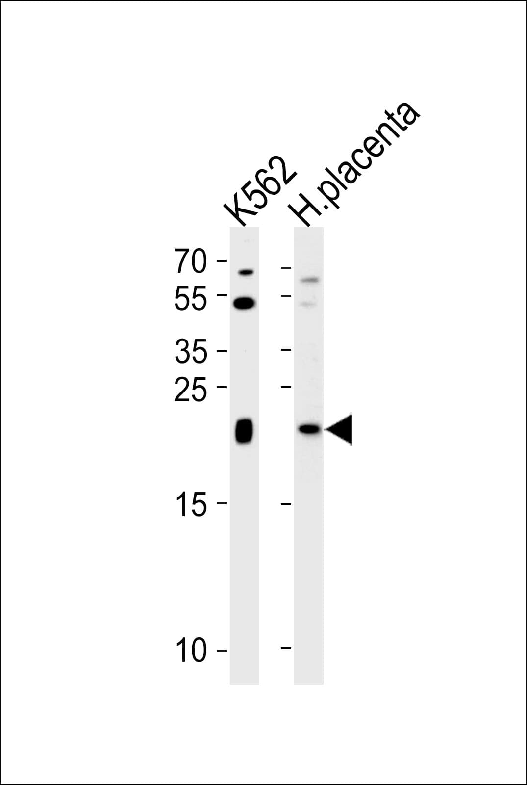 Polyclonal Rabbit anti-Human IL31 Antibody (aa13-40, IHC, WB)