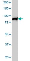Monoclonal Mouse anti-Human MLH1 Antibody (clone M1, IF, WB)