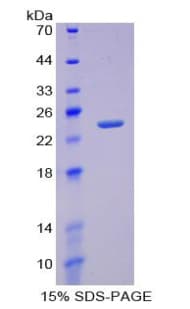 Rat TNFRSF11A / RANK Protein (Recombinant His-T7)