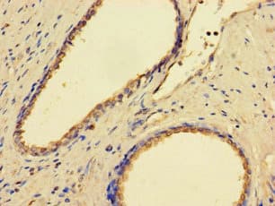 Polyclonal Rabbit anti-Human GMPPB Antibody
