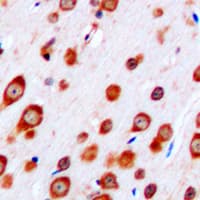 IHC-plus™ Polyclonal Rabbit anti-Human CRHR2 / CRF2 Receptor Antibody (Internal, IHC, WB)