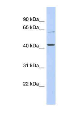 URAT1 / SLC22A12 Antibody (aa35-84, FITC)