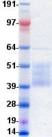 Human IGF1R / IGF1 Receptor Protein (Recombinant DDK (Flag)-His, C-terminus)