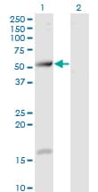 TCP11 Antibody (clone 2E3)