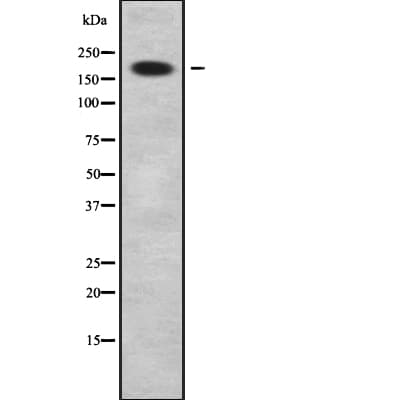 SUR2 / ABCC9 Antibody