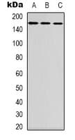 Polyclonal Rabbit anti-Human FANCD2 Antibody (N-Terminus, IHC, WB)
