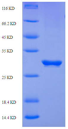 Human PDCD1 / CD279 / PD-1 Protein (Recombinant His-SUMO)