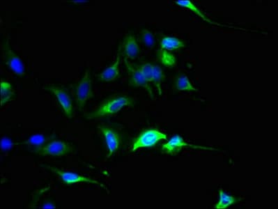 Polyclonal Rabbit anti-Human SLC44A4 Antibody