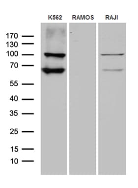 MPS1 / TTK Antibody (aa189-464, clone OTI13E9)