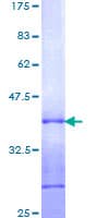 Human QSOX1 / QSCN6 Protein (Recombinant GST, N-terminus)
