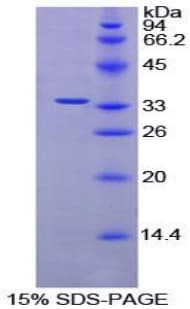 Rat AMY2A / Pancreatic Amylase Protein (Recombinant His-T7)