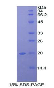 Mouse A2M / Alpha-2-Macroglobulin Protein (Recombinant His)