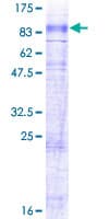 Human SLC6A7 Protein (Recombinant GST)