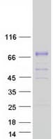 Human KLKB1 / Plasma Kallikrein Protein (Recombinant Myc-DDK (Flag))