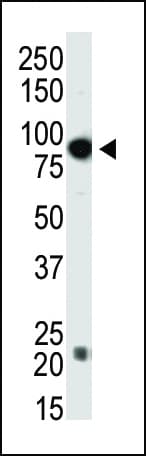 DNMT3B Antibody (aa389-417)