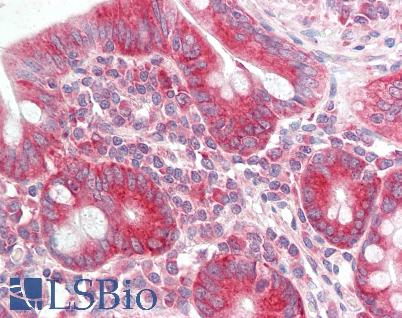IHC-plus™ ATG18 / WIPI1 Antibody
