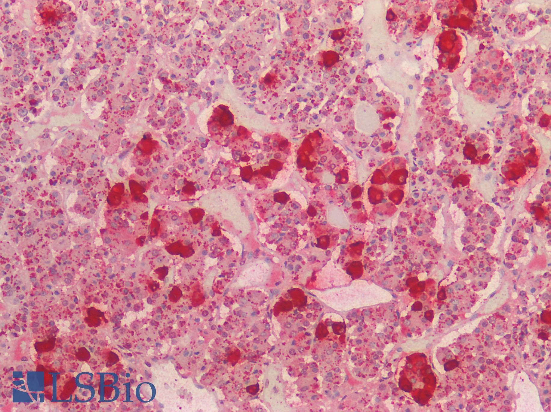 IHC-plus™ Polyclonal Rabbit anti-Human POMC / Proopiomelanocortin Antibody (IHC)