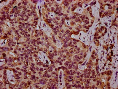 Polyclonal Rabbit anti-Human HIST1H3A Antibody (IHC)
