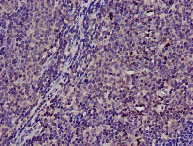 TMSB4X / Thymosin Beta-4 Antibody