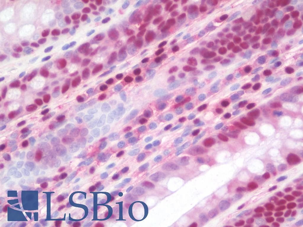 IHC-plus™ LTA4H / LTA4 Antibody (clone 9G8)