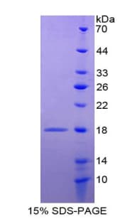 Rat AGRP Protein (Recombinant 6His, N-terminus)