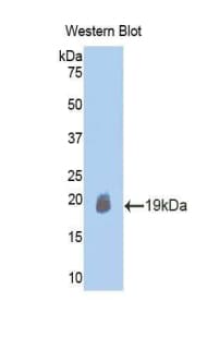 ACTRIIB / ACVR2B Antibody (aa342-482)