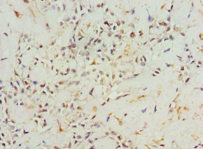 AGR2 Antibody (aa21-175)