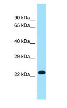 Polyclonal Rabbit anti-Human RPL19 / Ribosomal Protein L19 Antibody (C-Terminus, WB)