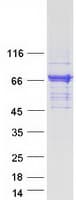 Human CAMKK2 Protein (Recombinant Myc-DDK (Flag))