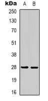 YWHAE / 14-3-3 Epsilon Antibody