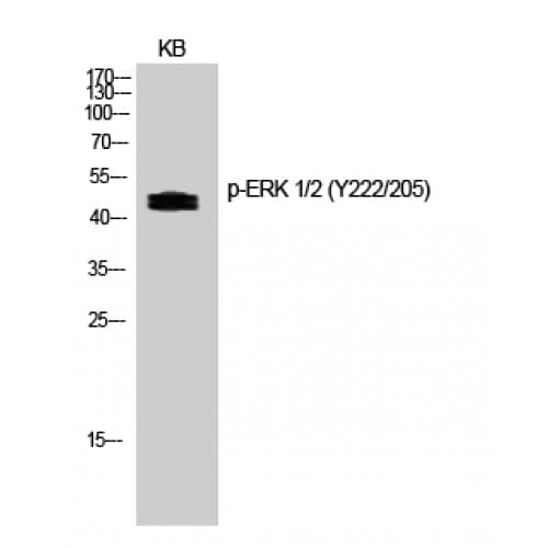 ERK1 + ERK2 Antibody (140-220 aa)