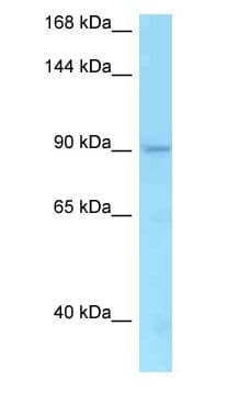 TMEM63A Antibody (aa701-750)