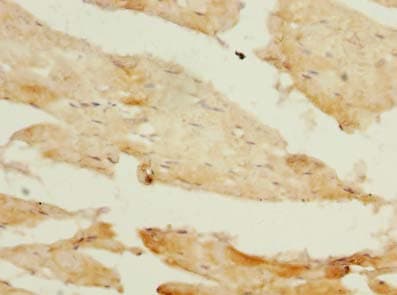 PIK3R1 / p85 Alpha Antibody