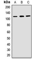 Polyclonal Rabbit anti-Human PCDH1 / PCD1 Antibody (WB)