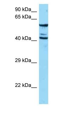 Polyclonal Rabbit anti-Human ESAM Antibody (N-Terminus, WB)