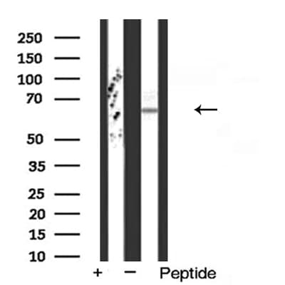 FZD2 / Frizzled 2 Antibody