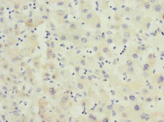 FHL3 Antibody