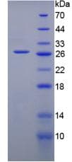 Mouse GREM1 / Gremlin-1 Protein (Recombinant His, N-Terminal)