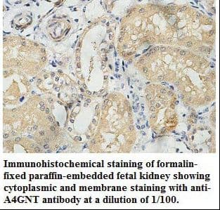 Alpha4GnT / A4GNT Antibody (aa96-318)