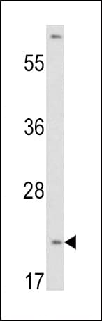 VHL / Von Hippel Lindau Antibody (aa43-71)