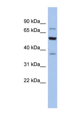 Polyclonal Rabbit anti-Human GARS / Glycyl tRNA Synthetase Antibody (aa575-624, WB)