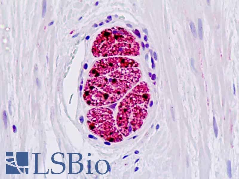 PathPlus™ S100B / S100 Beta Antibody