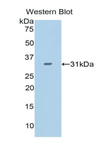 IDH1 / IDH Antibody (aa78-330)