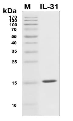 Human IL31 Protein (Recombinant 6His, N-terminus)
