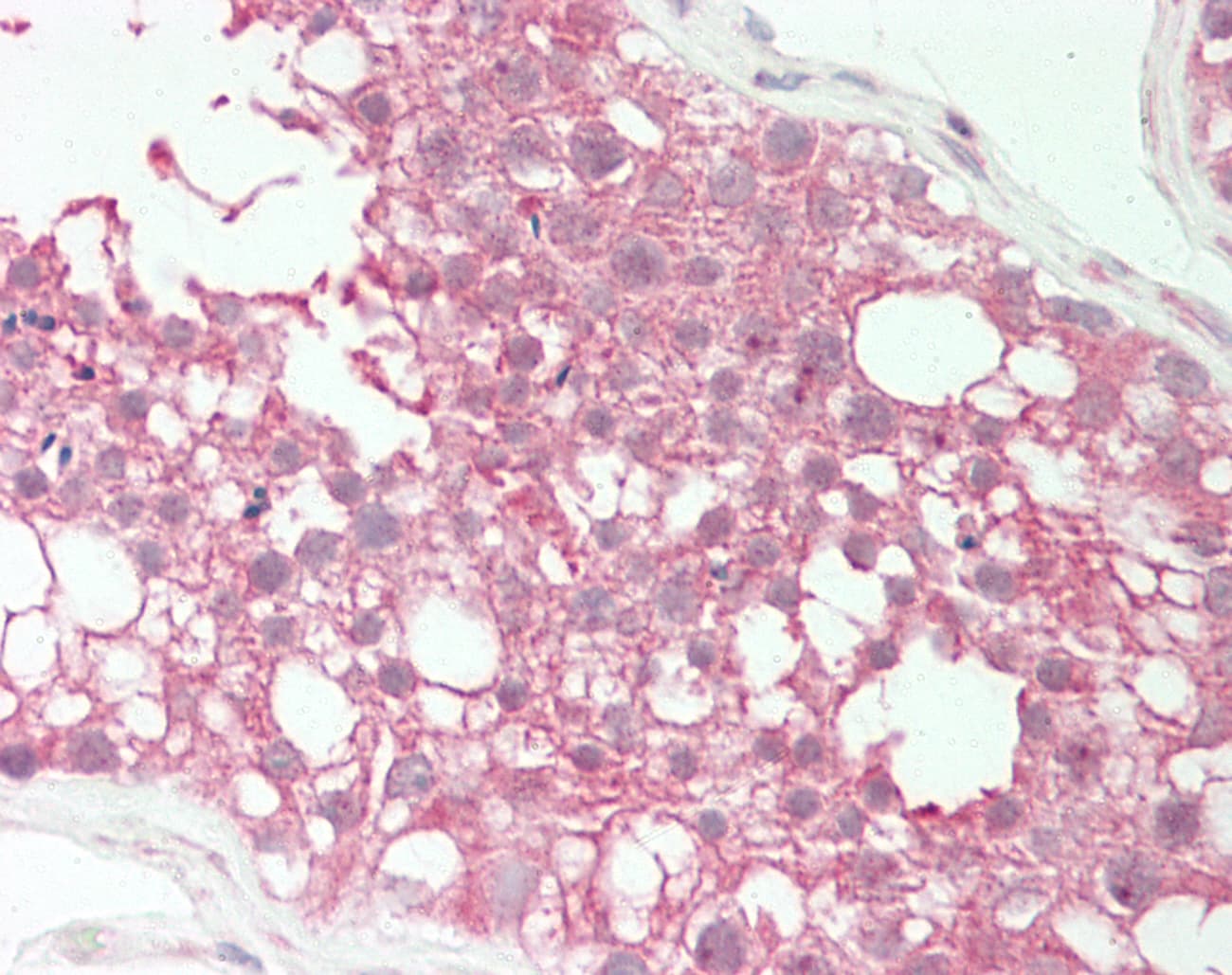 IHC-plus™ TOPAZ1 Antibody