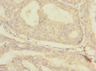 Polyclonal Rabbit anti-Human SLC30A1 / ZNT1 Antibody (IHC, WB)