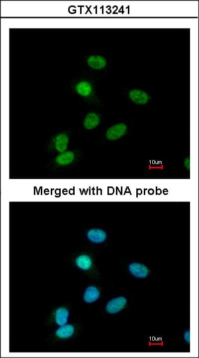 Polyclonal Rabbit anti-Human PAX6 Antibody (IF, WB)