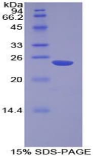 Human NME6 Protein (Recombinant His-T7)