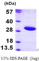 Human SIRT3 / Sirtuin 3 Protein (Recombinant His)